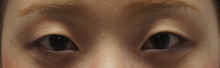 くぼみ目で眉毛を上げるクセがある人の平行型