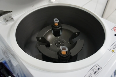 ベイザーで吸引した脂肪を顔に注入することもできます