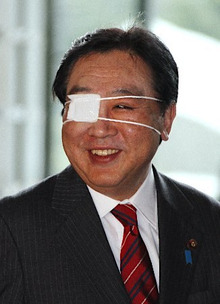 野田総理大臣　右目の埋没法なんじゃないの？