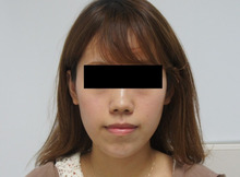21歳の女性アゴのレディエッセ
