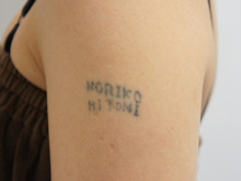 自分で彫ったTattooのQ-スイッチYAGレーザー除去　3回まで