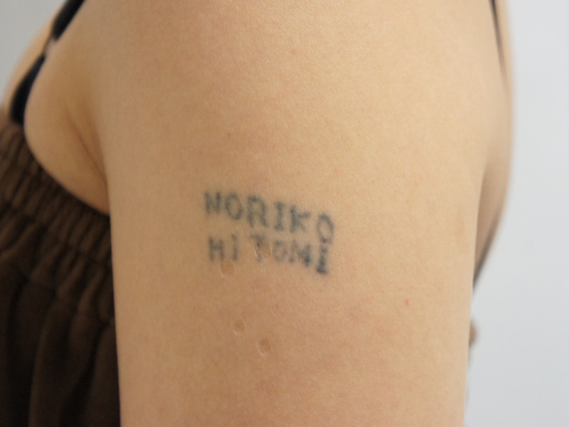 自分で彫ったTATTOOのレーザー4回施術後（あとちょっと(^_^;)）