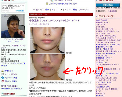 アメブロの画像を保存する方法。　（スクリプト使用しないで）