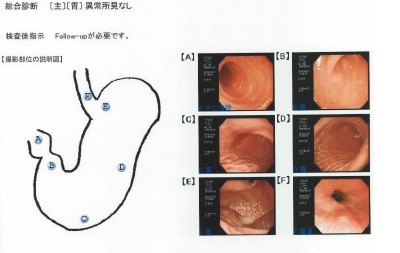 僕の“腹のうち”お見せいたします(●´ω｀●)ゞ