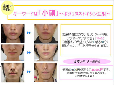 小顔を手に入れる方法は一つではありません(*｀･ω･´)ゞ