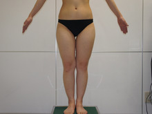 31歳女性　150㎝42㎏　下半身太りに大腿臀部膝まわりベイザー