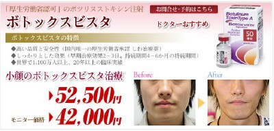 小顔のボトックスビスタのモニターを募集開始しました。