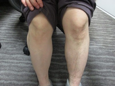 なんか左脚も脱毛したくなってきた(;^_^A