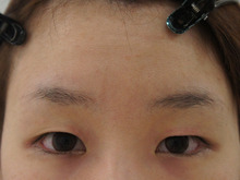蒙古ひだが強めの一重で眉毛を挙げて視界確保している場合のプレミアムクイック