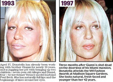ヴェルサーチのチーフデザイナー（Donatella Versace ）に何があったのか・・・