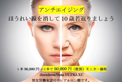 ジュビダームビスタ　ウルトラXC2本でほうれい線モニター募集！！