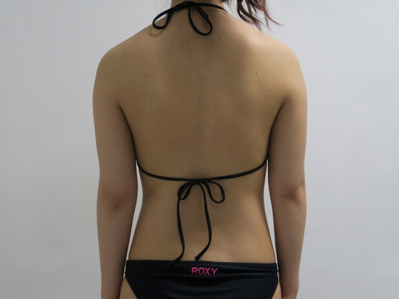 19歳女性　163cm51kg　もったり二の腕解消ベイザー！！