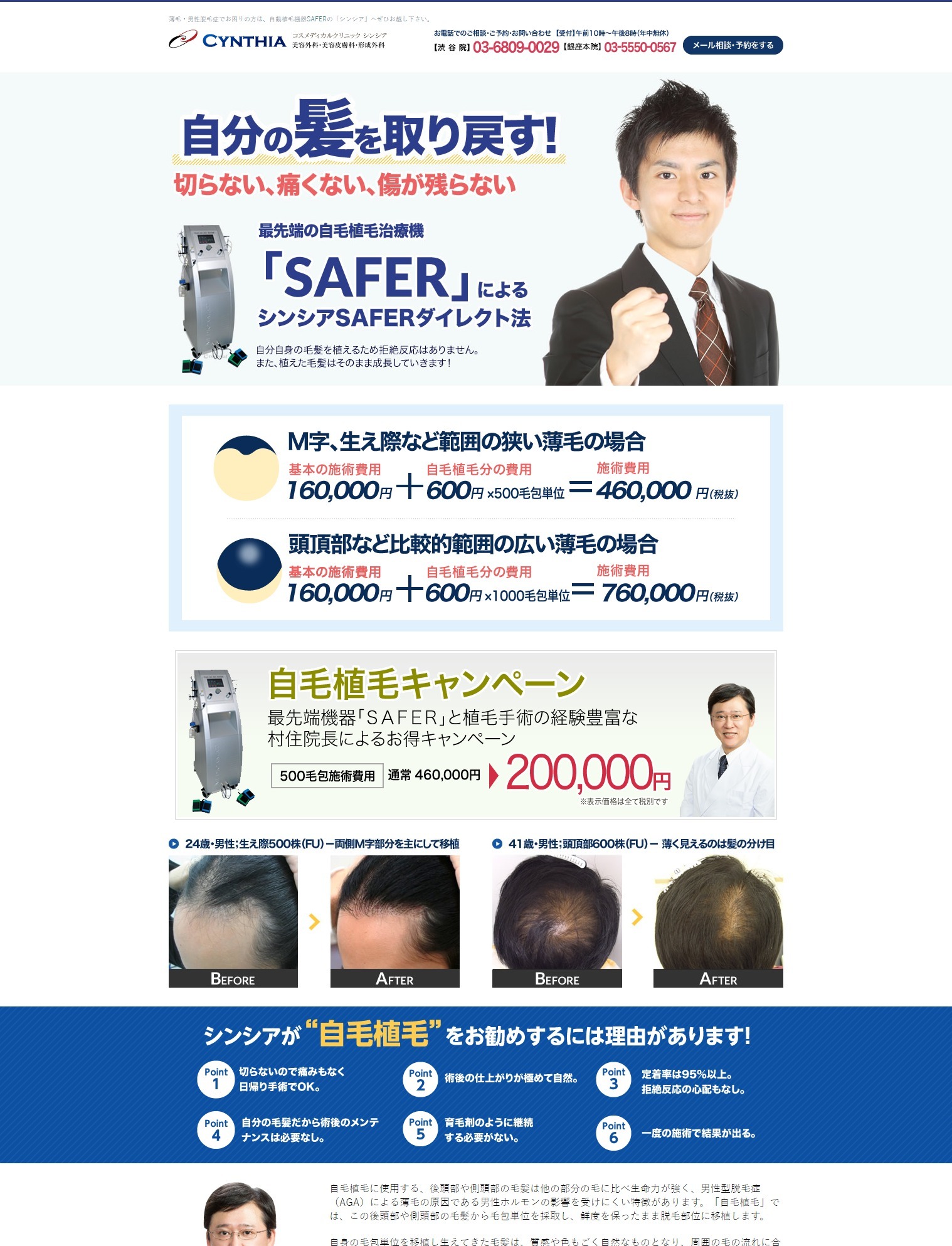 植毛、毛髪再生治療サイト　もうすぐ完成