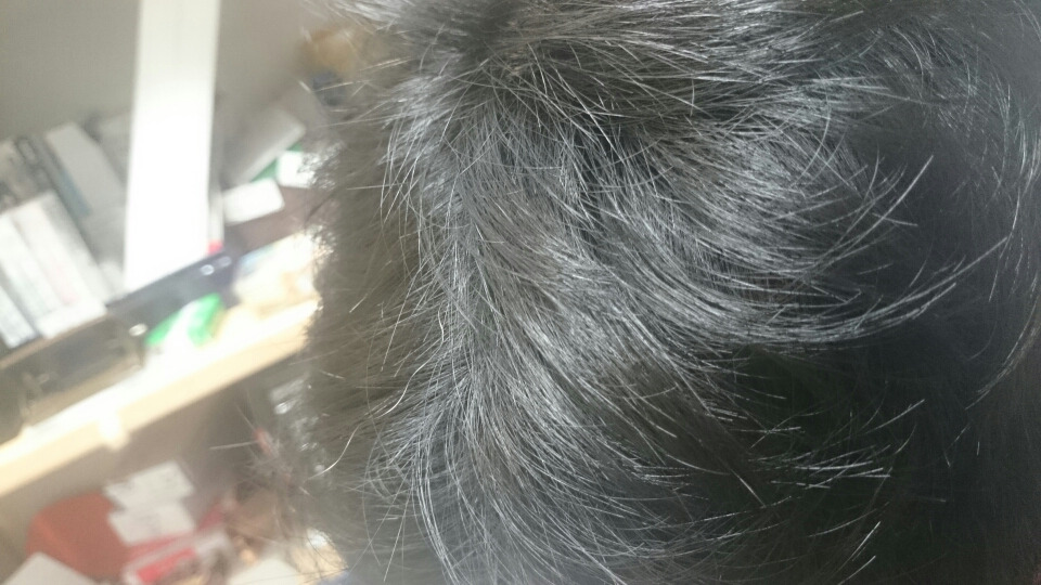 白髪発見