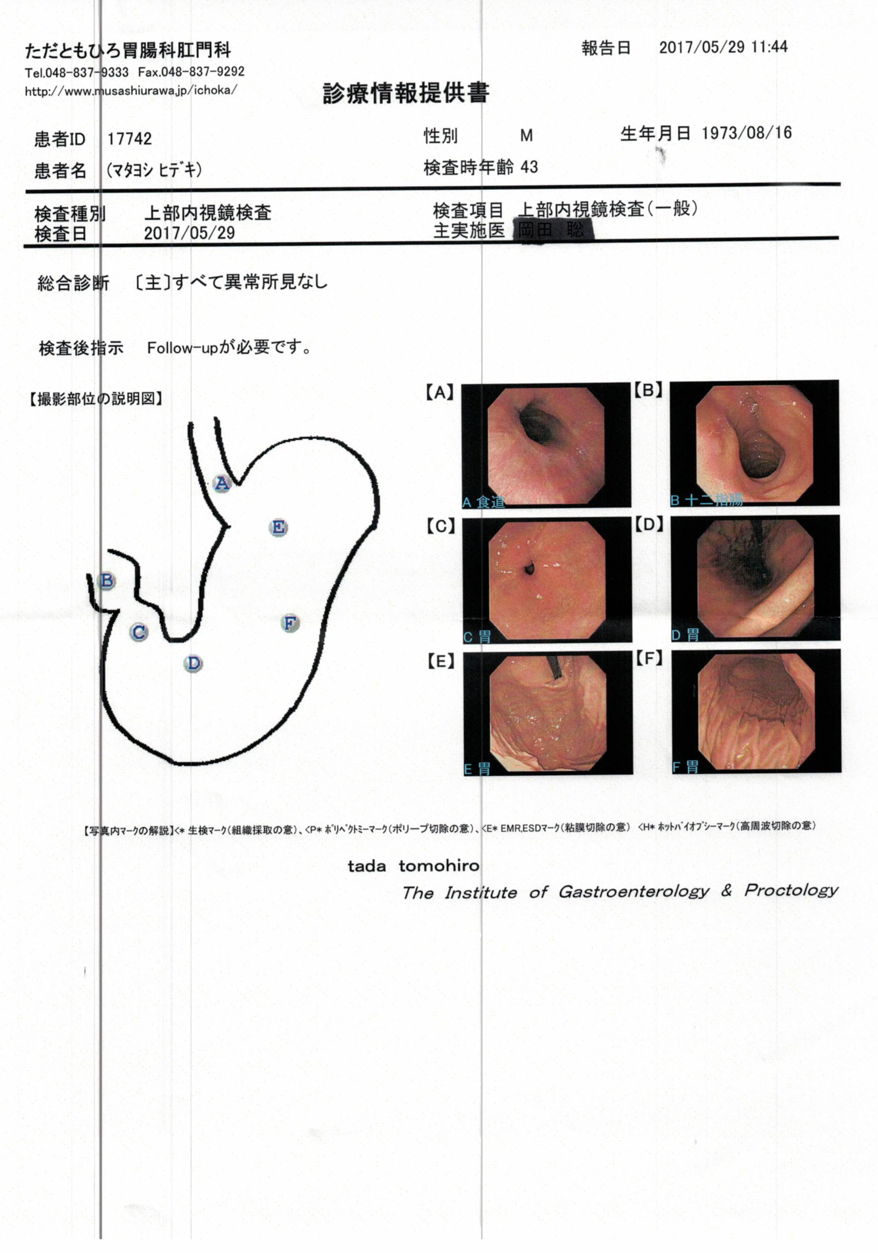 僕の腹の内お見せします(;^ω^A　　　　2017年5月版