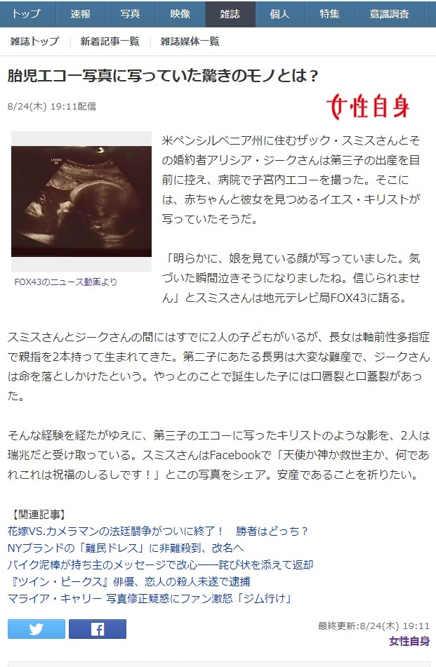 エコーに写っていた人とは・・・