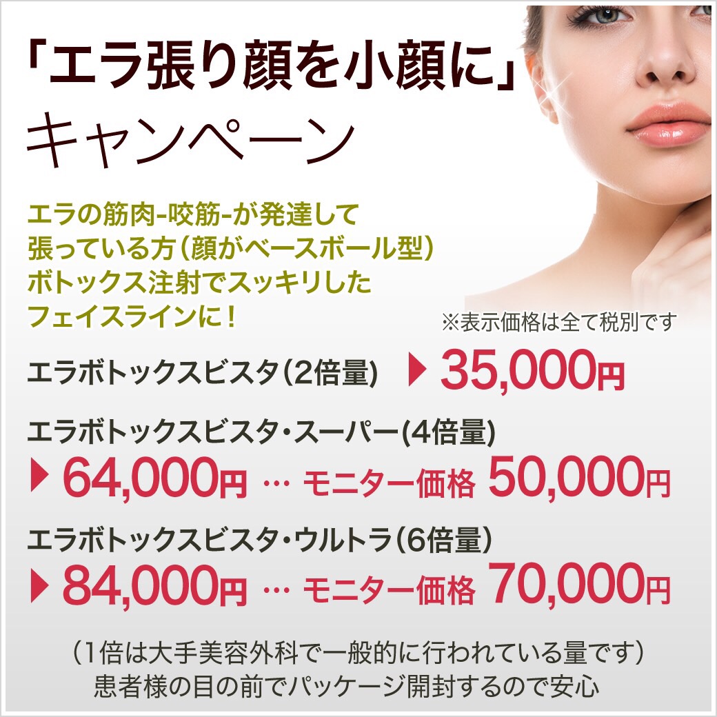 エラのボトックスビスタを大幅値下げしました！！