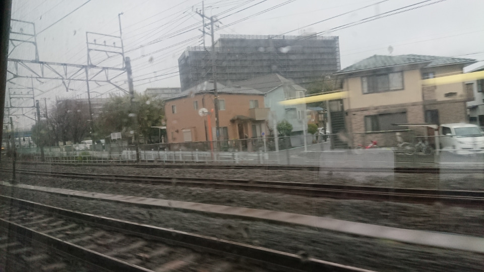 大船の又吉歯科医院で歯のチェック