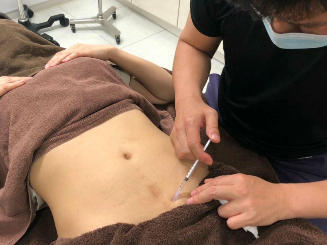 新しい脂肪溶解注射？