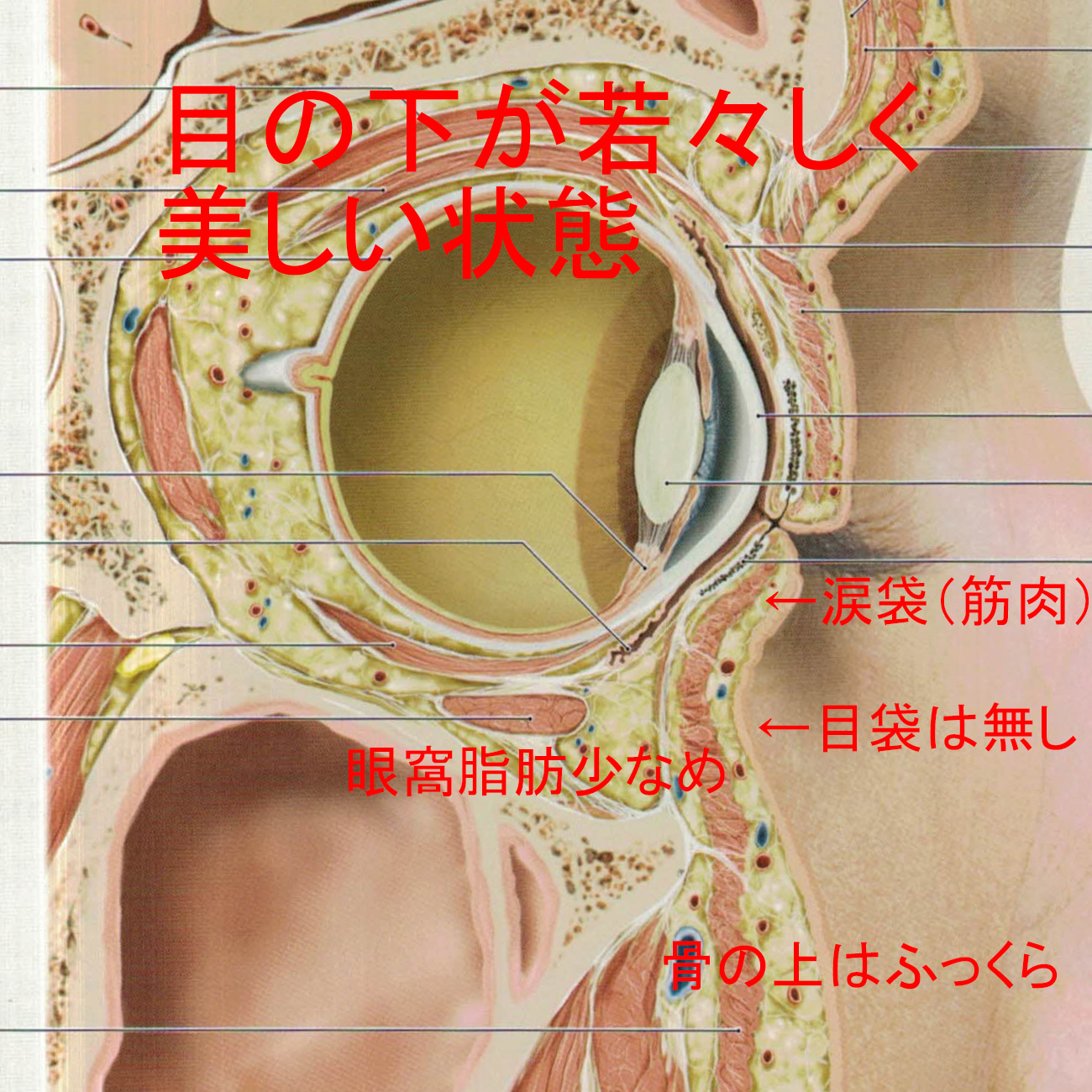 ハムラ法・裏ハムラ法（脂肪再配置）が”確実に再発”する理由　1　※ハムラ法と経結膜脱脂術の違い