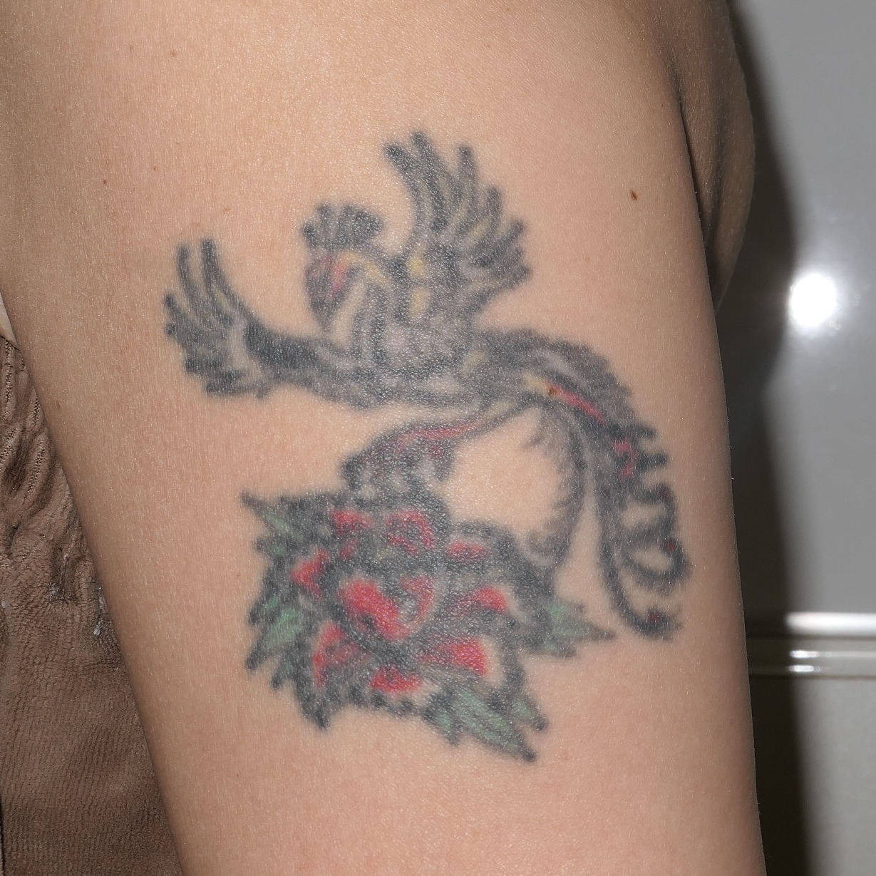 【黒・赤・緑】左腕のTattoo　Q-スイッチYAGレーザー　　2回