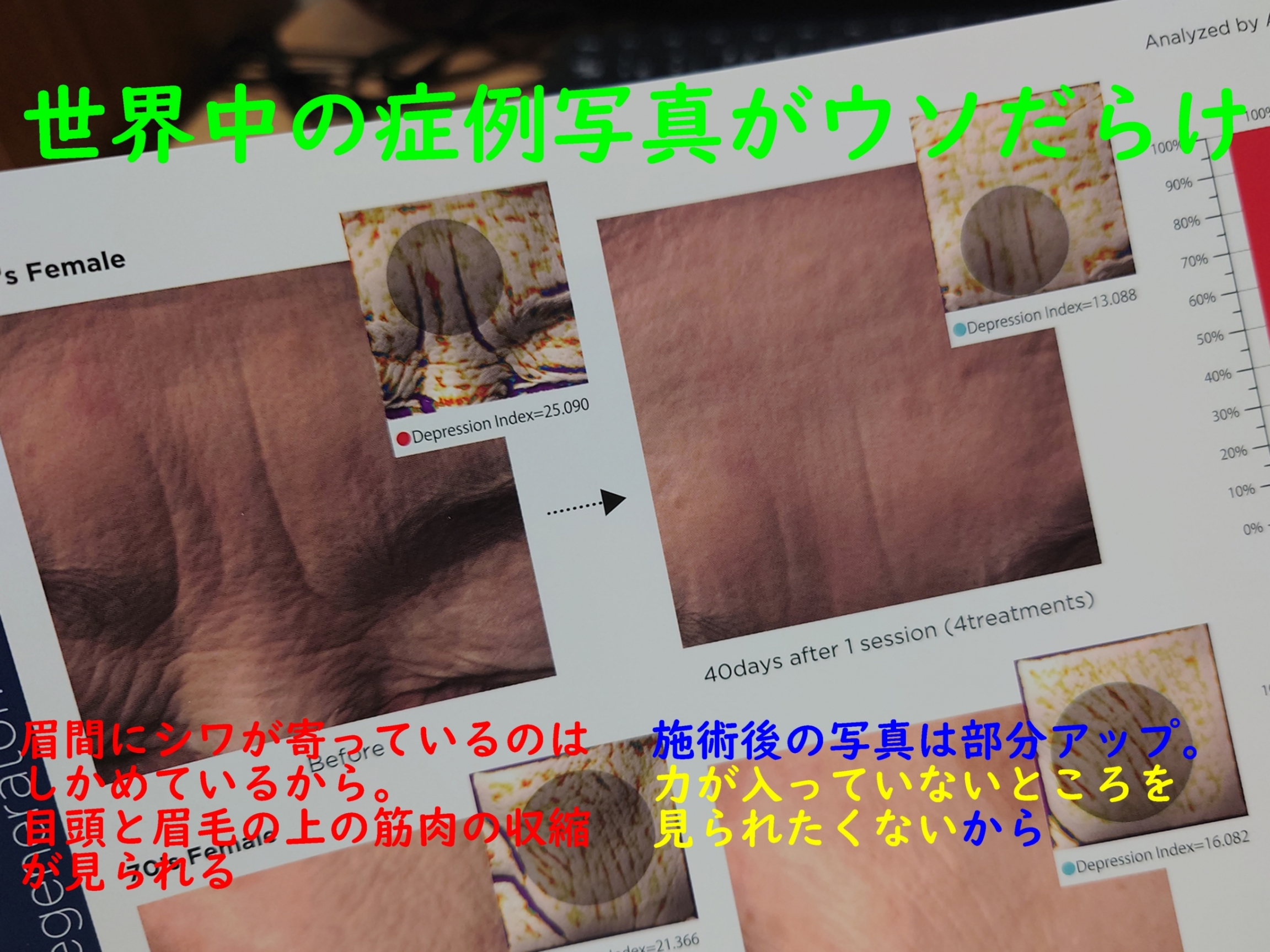 美容皮膚科のウソつき症例写真