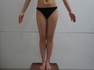01術前