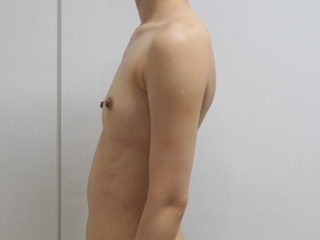 03術前