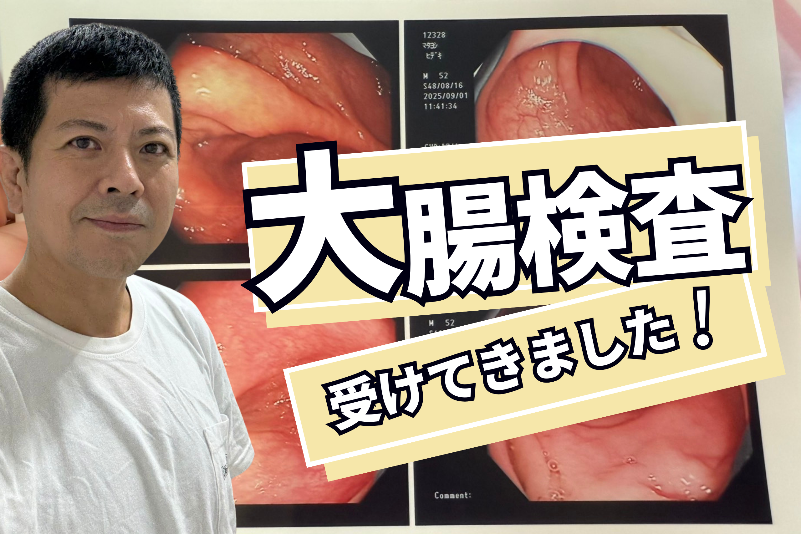 大腸検査を受けてきました！
