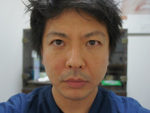 シンシア～Sincerely Yours　銀座の美容外科・美容皮膚科-ほうれい線　ヒアルロン酸　法令線　名医　口コミ