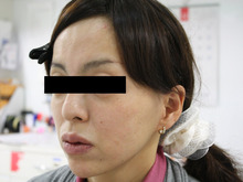 シンシア～Sincerely Yours　銀座の美容外科・美容皮膚科-ヒアルロン酸　大量　若返り　名医　口コミ
