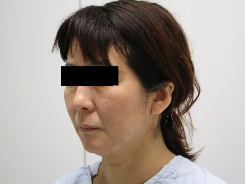シンシア～Sincerely Yours　銀座の美容外科・美容皮膚科-フェイスリフト　口コミ　名医　格安