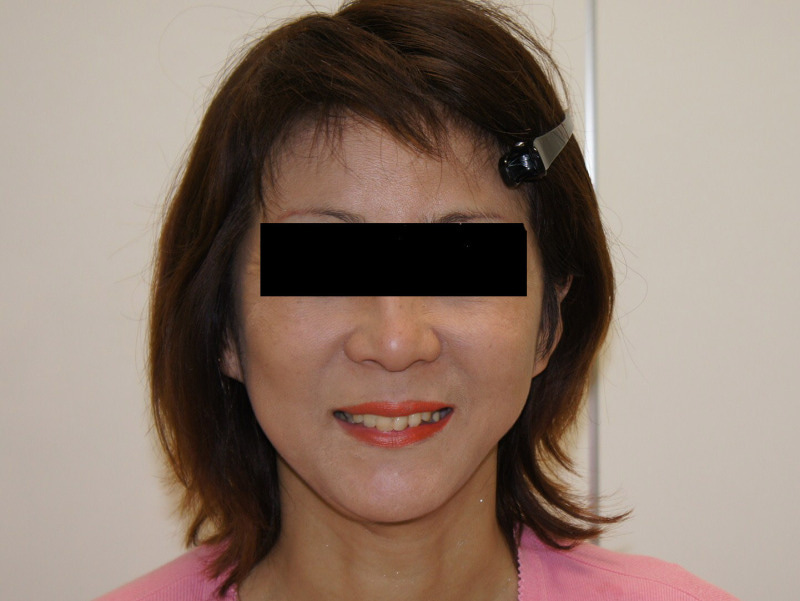 シンシア～Sincerely Yours　銀座の美容外科・美容皮膚科-フェイスリフト　口コミ　名医　成功
