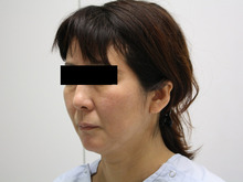 シンシア～Sincerely Yours　銀座の美容外科・美容皮膚科-フェイスリフト　口コミ　名医　評価