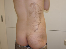シンシア～Sincerely Yours　銀座の美容外科・美容皮膚科-Tattoo 入れ墨 刺青 レーザー　格安　