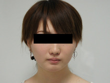 シンシア～Sincerely Yours　銀座の美容外科・美容皮膚科-顔やせ 脂肪吸引　頬　アゴ　名医　口コミ