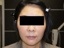 シンシア～Sincerely Yours　銀座の美容外科・美容皮膚科-若返り　ヒアルロン酸　大量　名医　口コミ