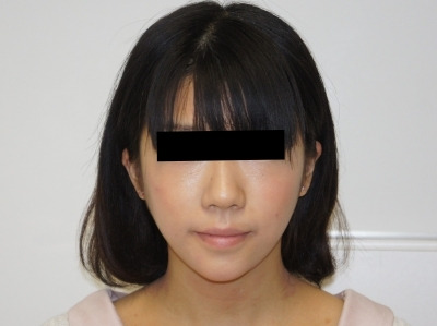 シンシア～Sincerely Yours　銀座の美容外科・美容皮膚科-頬　アゴ　ベイザー　レディエッセ　東京