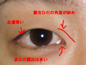 シンシア～Sincerely Yours　銀座の美容外科・美容皮膚科