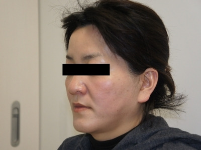 シンシア～Sincerely Yours　銀座の美容外科・美容皮膚科-フェイスリフト 後戻り 東京 名医 評判