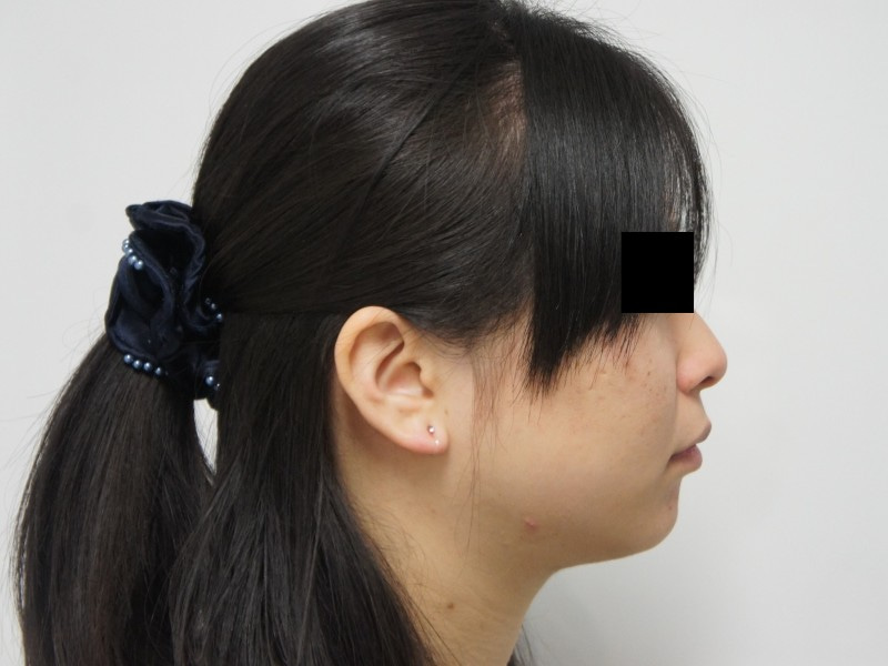 シンシア～Sincerely Yours　銀座の美容外科・美容皮膚科-東京　銀座　VASER　ベイザー