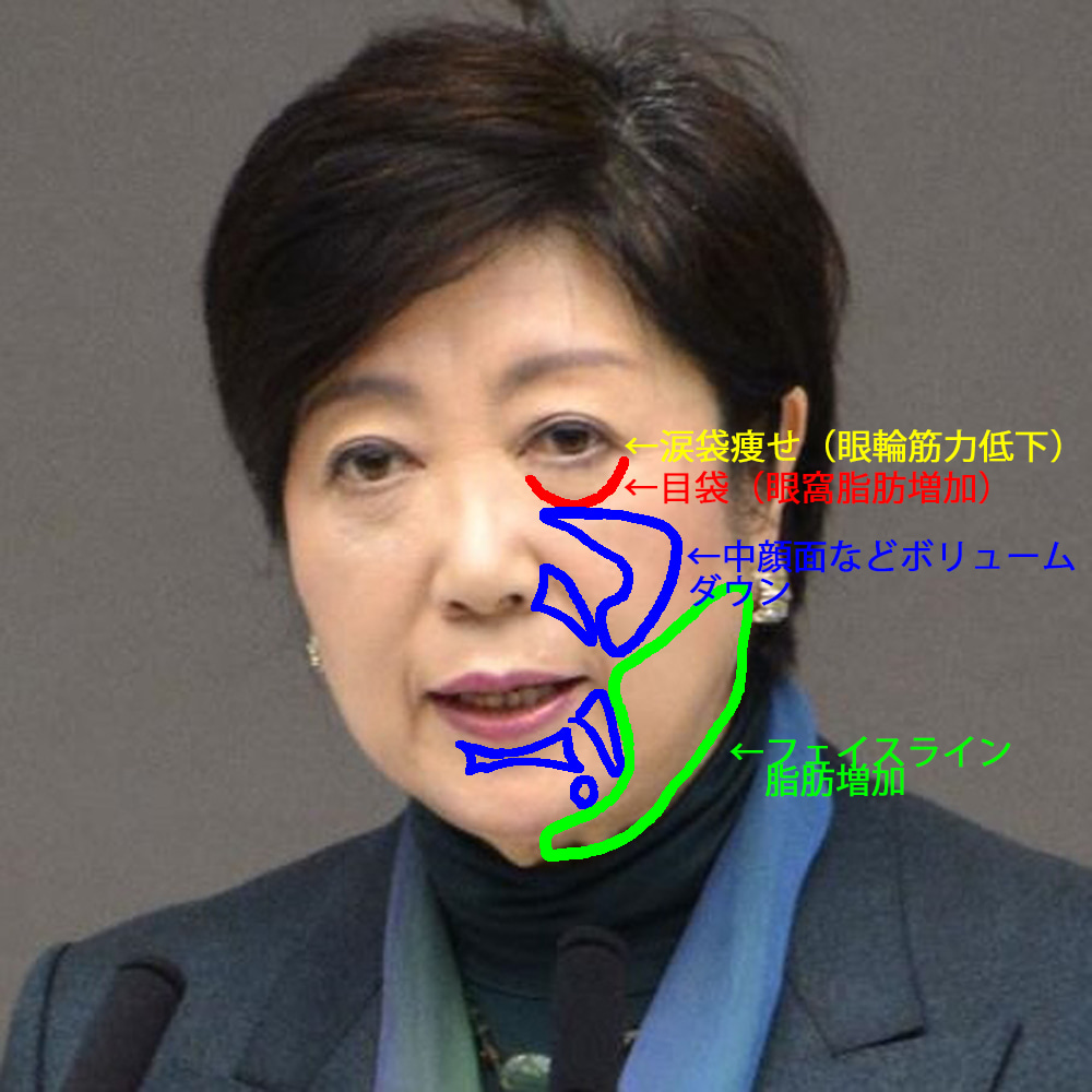 小池百合子　顔 