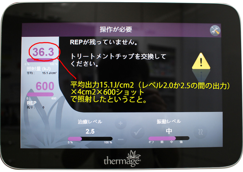 サーマクールFLXでお顔のたるみを改善| 美容外科のシンシア サーマクールFLXでお顔のたるみを改善| 美容外科のシンシア