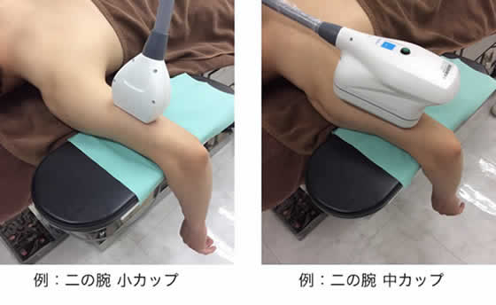 小カップと中カップの比較