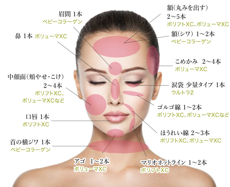 ヒアルロン酸注入によるシワ改善 | 美容外科のシンシア