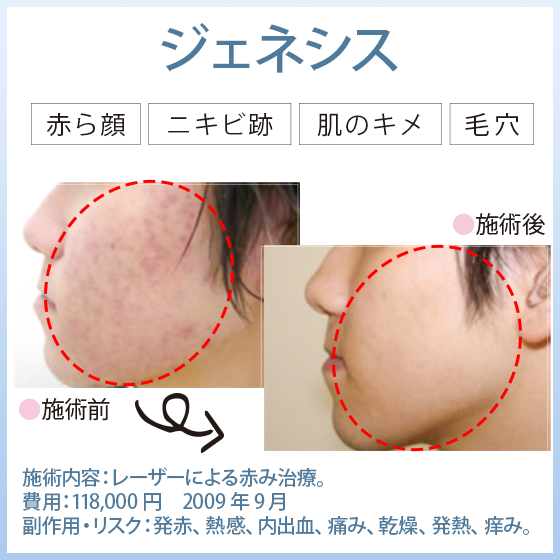 ジェネシス