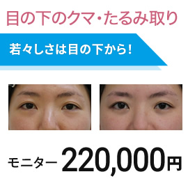 目の下のクマ・たるみ取り モニター