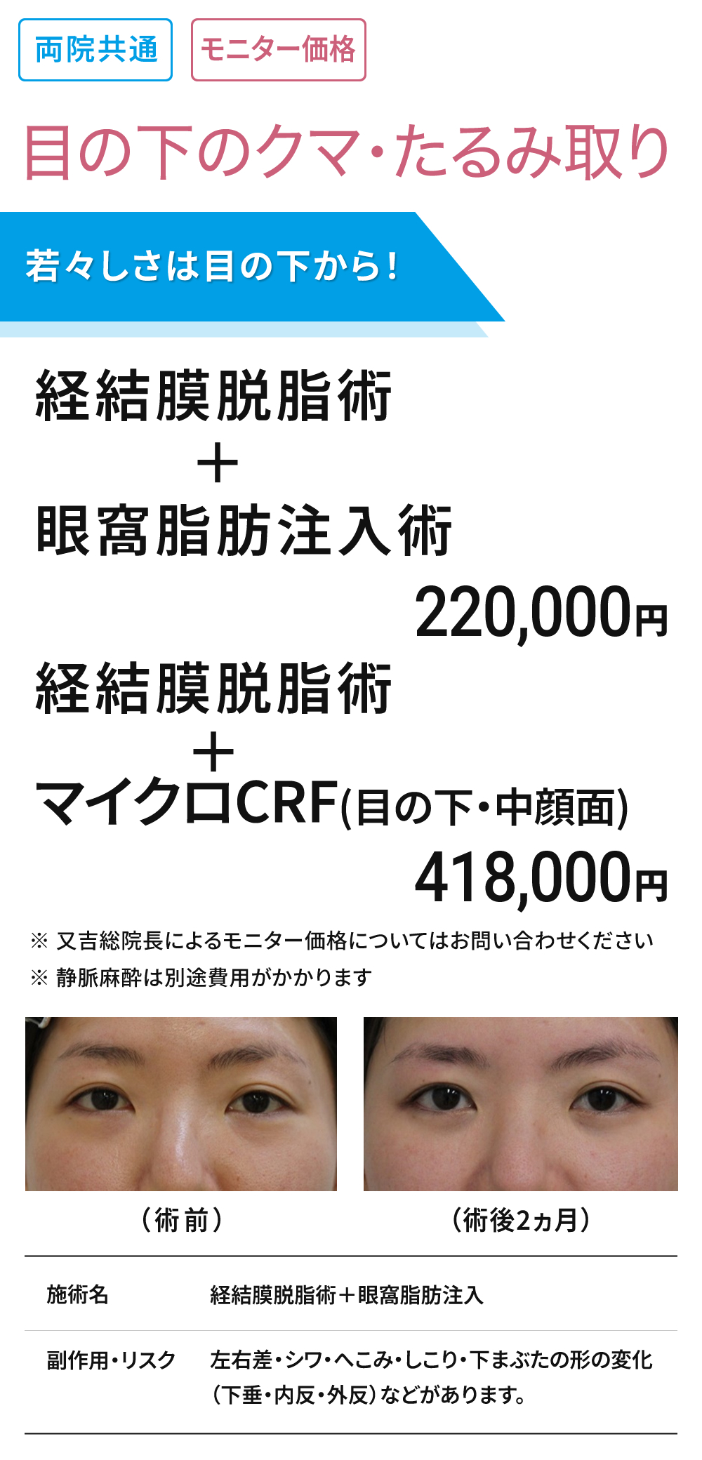 両院共通　目の下のクマ・たるみ取り モニター