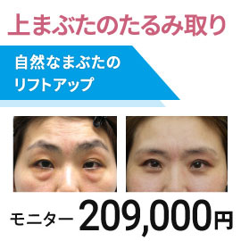 上まぶたのたるみ取り　モニター
