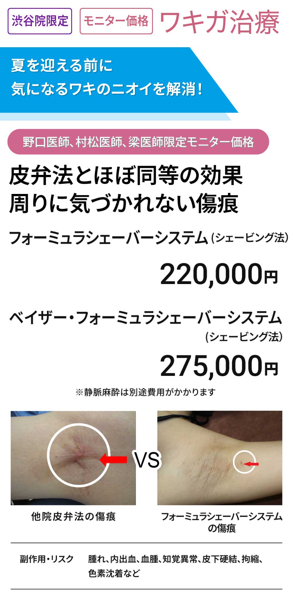 渋谷院限定　ワキガ治療　モニター